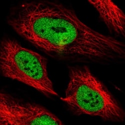 PHF3 Antibody, Novus Biologicals:Antibodies:Primary Antibodies